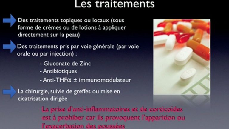 Maladie de verneuil, tout savoir sur cette affection