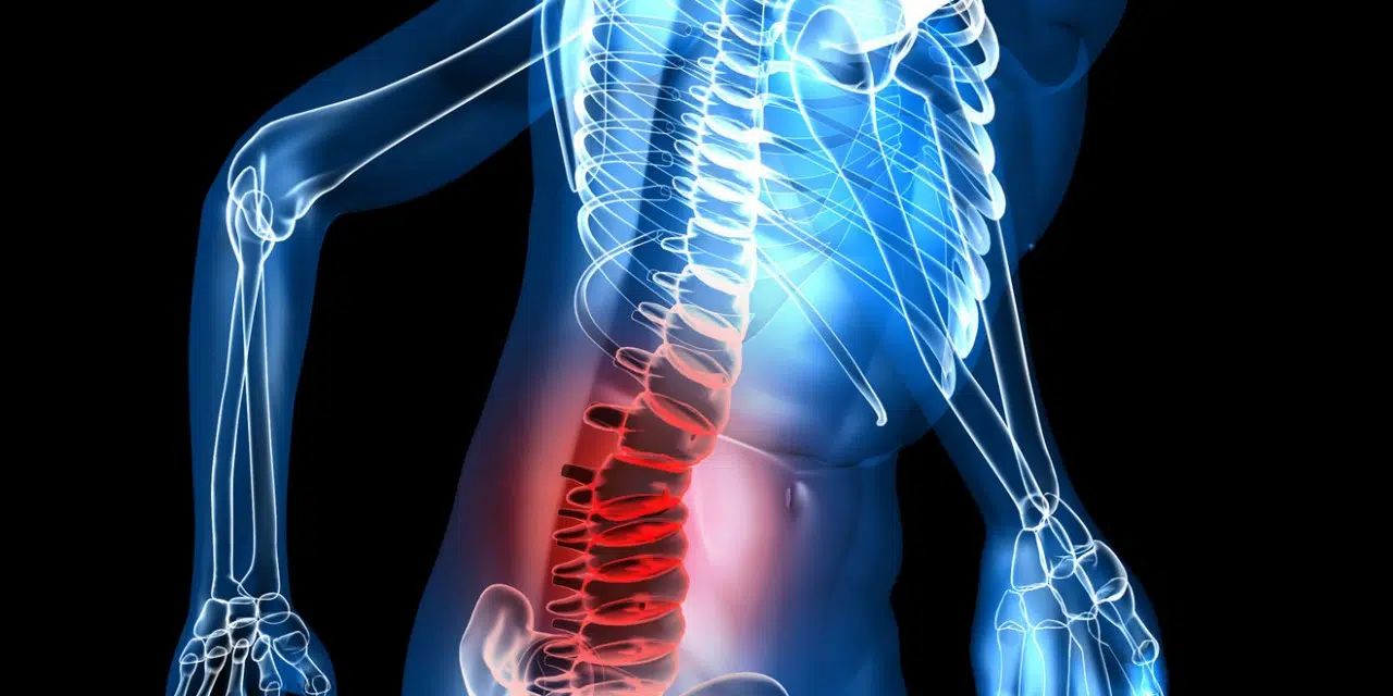 Atténuer les douleurs causées par arthrose dorsale 