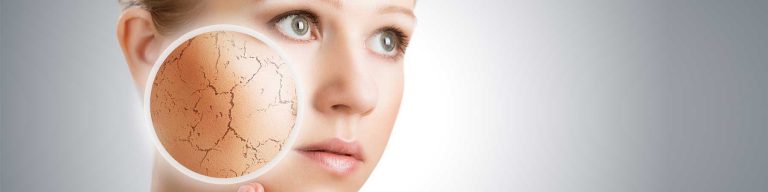 Comment soigner le psoriasis ?