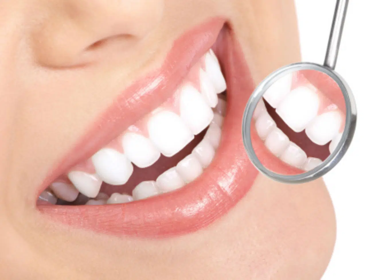 Comment se présente un implant dentaire ?